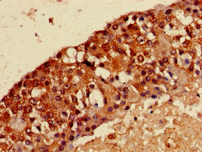 MAGEA8 Antibody - Immunohistochemistry of paraffin-embedded human lung tissue using MAGEA8 Antibody at dilution of 1:100
