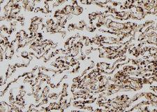 MAGEA8 Antibody - 1:100 staining human lung tissue by IHC-P. The sample was formaldehyde fixed and a heat mediated antigen retrieval step in citrate buffer was performed. The sample was then blocked and incubated with the antibody for 1.5 hours at 22°C. An HRP conjugated goat anti-rabbit antibody was used as the secondary.