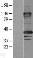 MAGEA8 Protein - Western validation with an anti-DDK antibody * L: Control HEK293 lysate R: Over-expression lysate