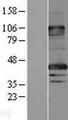 MAGEA8 Protein - Western validation with an anti-DDK antibody * L: Control HEK293 lysate R: Over-expression lysate