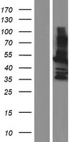 MAGEA8 Protein - Western validation with an anti-DDK antibody * L: Control HEK293 lysate R: Over-expression lysate