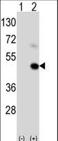 MAGEA9 Antibody - Western blot of MAGEA9 (arrow) using rabbit polyclonal MAGEA9 Antibody (C185). 293 cell lysates (2 ug/lane) either nontransfected (Lane 1) or transiently transfected (Lane 2) with the MAGEA9 gene.