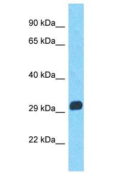 MAGEA9 Antibody - MAGEA9B antibody Western Blot of COLO205. Antibody dilution: 1 ug/ml.  This image was taken for the unconjugated form of this product. Other forms have not been tested.