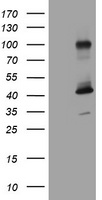 MAGEA9 Antibody - HEK293T cells were transfected with the pCMV6-ENTRY control (Left lane) or pCMV6-ENTRY MAGEA9 (Right lane) cDNA for 48 hrs and lysed. Equivalent amounts of cell lysates (5 ug per lane) were separated by SDS-PAGE and immunoblotted with anti-MAGEA9.