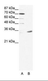 MAGEA9 Antibody - A: Marker, B: HepG2 Cell Lysate.  This image was taken for the unconjugated form of this product. Other forms have not been tested.