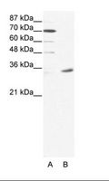 MAGEA9 Antibody - A: Marker, B: HepG2 Cell Lysate.  This image was taken for the unconjugated form of this product. Other forms have not been tested.