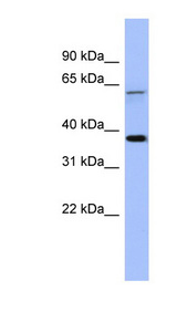 MAGEB1 Antibody - MAGEB1 antibody Western blot of Fetal Brain lysate. This image was taken for the unconjugated form of this product. Other forms have not been tested.
