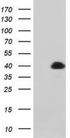 MAGEB1 Antibody - HEK293T cells were transfected with the pCMV6-ENTRY control (Left lane) or pCMV6-ENTRY MAGEB1 (Right lane) cDNA for 48 hrs and lysed. Equivalent amounts of cell lysates (5 ug per lane) were separated by SDS-PAGE and immunoblotted with anti-MAGEB1.