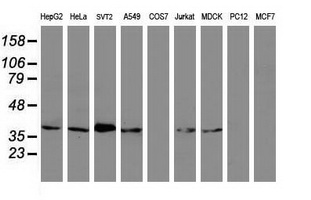 MAGEB1 Antibody - Western blot of extracts (35 ug) from 9 different cell lines by using anti-MAGEB1 monoclonal antibody (HepG2: human; HeLa: human; SVT2: mouse; A549: human; COS7: monkey; Jurkat: human; MDCK: canine; PC12: rat; MCF7: human).