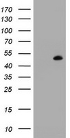 MAGEB1 Antibody - HEK293T cells were transfected with the pCMV6-ENTRY control (Left lane) or pCMV6-ENTRY MAGEB1 (Right lane) cDNA for 48 hrs and lysed. Equivalent amounts of cell lysates (5 ug per lane) were separated by SDS-PAGE and immunoblotted with anti-MAGEB1.