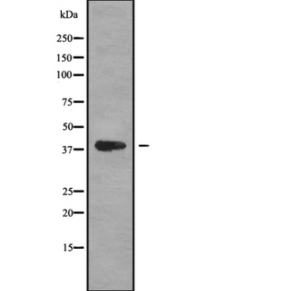 MAGEB1 Antibody - Western blot analysis of MAGB1 using HepG2 whole cells lysates