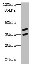 MAGEB10 Antibody - Western blot All lanes: MAGEB10 antibody at 12µg/ml + Mouse heart tissue Secondary Goat polyclonal to rabbit IgG at 1/10000 dilution Predicted band size: 39 kDa Observed band size: 39, 35 kDa