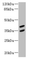MAGEB10 Antibody - Western blot All lanes: MAGEB10 antibody at 12µg/ml + Mouse heart tissue Secondary Goat polyclonal to rabbit IgG at 1/10000 dilution Predicted band size: 39 kDa Observed band size: 39, 35 kDa