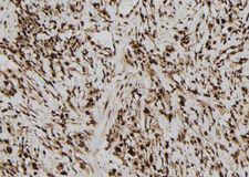 MAGEB10 Antibody - 1:100 staining human gastric tissue by IHC-P. The sample was formaldehyde fixed and a heat mediated antigen retrieval step in citrate buffer was performed. The sample was then blocked and incubated with the antibody for 1.5 hours at 22°C. An HRP conjugated goat anti-rabbit antibody was used as the secondary.