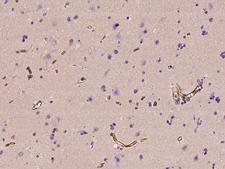 MAGEB10 Antibody - Immunochemical staining of human MAGEB10 in human brain with rabbit polyclonal antibody at 1:500 dilution, formalin-fixed paraffin embedded sections.