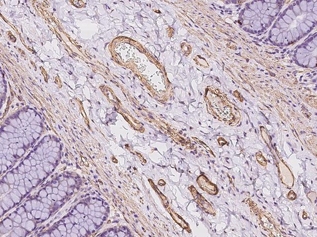 MAGEB10 Antibody - Immunochemical staining of human MAGEB10 in human rectum with rabbit polyclonal antibody at 1:500 dilution, formalin-fixed paraffin embedded sections.