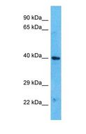 MAGEB10 Antibody - Western blot of MAGEB10 Antibody with human HepG2 Whole Cell lysate.  This image was taken for the unconjugated form of this product. Other forms have not been tested.