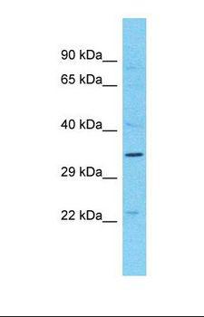 MAGEB10 Antibody - Western blot of Human PANC1. MAGEB10 antibody dilution 1.0 ug/ml.  This image was taken for the unconjugated form of this product. Other forms have not been tested.