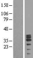 MAGEB10 Protein - Western validation with an anti-DDK antibody * L: Control HEK293 lysate R: Over-expression lysate
