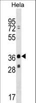 MAGEB16 Antibody - MAGEB16 Antibody western blot of HeLa cell line lysates (35 ug/lane). The MAGEB16 antibody detected the MAGEB16 protein (arrow).
