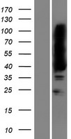 MAGEB16 Protein - Western validation with an anti-DDK antibody * L: Control HEK293 lysate R: Over-expression lysate