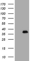 MAGEB18 Antibody - HEK293T cells were transfected with the pCMV6-ENTRY control (Left lane) or pCMV6-ENTRY MAGEB18 (Right lane) cDNA for 48 hrs and lysed. Equivalent amounts of cell lysates (5 ug per lane) were separated by SDS-PAGE and immunoblotted with anti-MAGEB18.