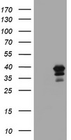MAGEB18 Antibody - HEK293T cells were transfected with the pCMV6-ENTRY control (Left lane) or pCMV6-ENTRY MAGEB18 (Right lane) cDNA for 48 hrs and lysed. Equivalent amounts of cell lysates (5 ug per lane) were separated by SDS-PAGE and immunoblotted with anti-MAGEB18.