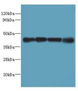 MAGEB18 Antibody - Western blot. All lanes: MAGEB18 antibody at 12 ug/ml. Lane 1: MCF7 whole cell lysate. Lane 2: A549 whole cell lysate. Lane 3: HeLa whole cell lysate. Lane 4: Mouse heart tissue. Secondary antibody: Goat polyclonal to Rabbit IgG at 1:10000 dilution. Predicted band size: 39 kDa. Observed band size: 39 kDa.