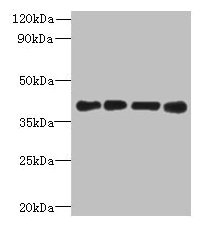 MAGEB18 Antibody - Western blot All lanes: MAGEB18 antibody at 12µg/ml Lane 1: MCF-7 whole cell lysate Lane 2: A549 whole cell lysate Lane 3: Hela whole cell lysate Lane 4: Mouse heart tissue Secondary Goat polyclonal to rabbit IgG at 1/10000 dilution Predicted band size: 39 kDa Observed band size: 39 kDa
