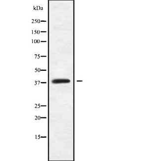 MAGEB18 Antibody - Western blot analysis of MAGBI using K562 whole cells lysates