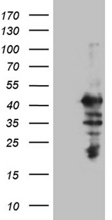 MAGEB2 Antibody - HEK293T cells were transfected with the pCMV6-ENTRY control. (Left lane) or pCMV6-ENTRY MAGEB2. (Right lane) cDNA for 48 hrs and lysed. Equivalent amounts of cell lysates. (5 ug per lane) were separated by SDS-PAGE and immunoblotted with anti-MAGEB2. (1:2000)
