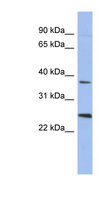 MAGEB2 Antibody - MAGEB2 antibody Western blot of Placenta lysate. This image was taken for the unconjugated form of this product. Other forms have not been tested.