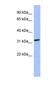 MAGEB2 Antibody - MAGEB2 antibody Western blot of Fetal Kidney lysate. This image was taken for the unconjugated form of this product. Other forms have not been tested.
