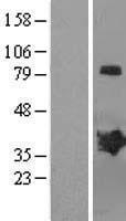 MAGEB2 Protein - Western validation with an anti-DDK antibody * L: Control HEK293 lysate R: Over-expression lysate