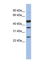 MAGEB3 Antibody - MAGEB3 antibody Western blot of Fetal Brain lysate. This image was taken for the unconjugated form of this product. Other forms have not been tested.
