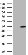 MAGEB3 Antibody - HEK293T cells were transfected with the pCMV6-ENTRY control. (Left lane) or pCMV6-ENTRY MAGEB3. (Right lane) cDNA for 48 hrs and lysed. Equivalent amounts of cell lysates. (5 ug per lane) were separated by SDS-PAGE and immunoblotted with anti-MAGEB3. (1:2000)