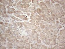 MAGEB3 Antibody - Immunohistochemical staining of paraffin-embedded Human pancreas tissue within the normal limits using anti-MAGEB3 mouse monoclonal antibody. (Heat-induced epitope retrieval by 1mM EDTA in 10mM Tris buffer. (pH8.5) at 120°C for 3 min. (1:150)