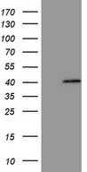 MAGEB3 Antibody - HEK293T cells were transfected with the pCMV6-ENTRY control. (Left lane) or pCMV6-ENTRY MAGEB3. (Right lane) cDNA for 48 hrs and lysed. Equivalent amounts of cell lysates. (5 ug per lane) were separated by SDS-PAGE and immunoblotted with anti-MAGEB3. (1:500)