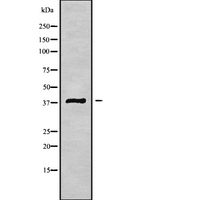 MAGEB3 Antibody - Western blot analysis of MAGB3 using HuvEc whole cells lysates