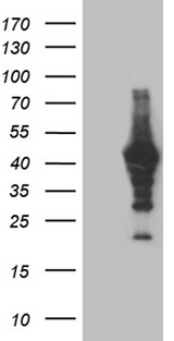 MAGEB4 Antibody - HEK293T cells were transfected with the pCMV6-ENTRY control. (Left lane) or pCMV6-ENTRY MAGEB4. (Right lane) cDNA for 48 hrs and lysed. Equivalent amounts of cell lysates. (5 ug per lane) were separated by SDS-PAGE and immunoblotted with anti-MAGEB4. (1:2000)