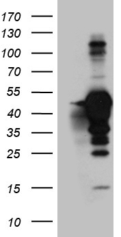 MAGEB4 Antibody - HEK293T cells were transfected with the pCMV6-ENTRY control. (Left lane) or pCMV6-ENTRY MAGEB4. (Right lane) cDNA for 48 hrs and lysed