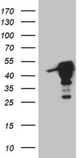 MAGEB4 Antibody - HEK293T cells were transfected with the pCMV6-ENTRY control. (Left lane) or pCMV6-ENTRY MAGEB4. (Right lane) cDNA for 48 hrs and lysed