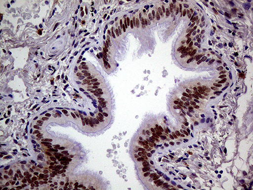 MAGEB4 Antibody - Immunohistochemical staining of paraffin-embedded Human lung tissue within the normal limits using anti-MAGEB4 mouse monoclonal antibody. (Heat-induced epitope retrieval by 1mM EDTA in 10mM Tris buffer. (pH8.5) at 120°C for 3 min. (1:500)