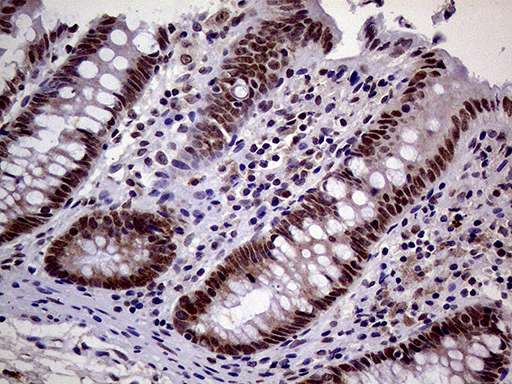 MAGEB4 Antibody - Immunohistochemical staining of paraffin-embedded Human colon tissue within the normal limits using anti-MAGEB4 mouse monoclonal antibody. (Heat-induced epitope retrieval by 1mM EDTA in 10mM Tris buffer. (pH8.5) at 120°C for 3 min. (1:500)