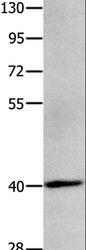 MAGEB4 Antibody - Western blot analysis of Human brain glioma tissue, using MAGEB4 Polyclonal Antibody at dilution of 1:550.