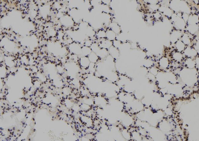 MAGEB5 Antibody - 1:100 staining mouse lung tissue by IHC-P. The sample was formaldehyde fixed and a heat mediated antigen retrieval step in citrate buffer was performed. The sample was then blocked and incubated with the antibody for 1.5 hours at 22°C. An HRP conjugated goat anti-rabbit antibody was used as the secondary.