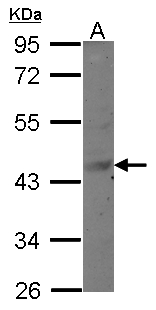 MAGEB6 Antibody - Sample (30 ug of whole cell lysate) A: MCF-7 10% SDS PAGE MAGEB6 antibody diluted at 1:500