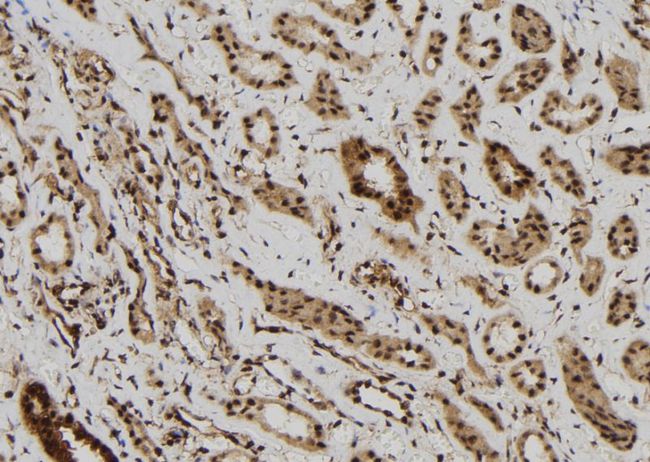 MAGEB6 Antibody - 1:100 staining human kidney tissue by IHC-P. The sample was formaldehyde fixed and a heat mediated antigen retrieval step in citrate buffer was performed. The sample was then blocked and incubated with the antibody for 1.5 hours at 22°C. An HRP conjugated goat anti-rabbit antibody was used as the secondary.