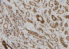 MAGEB6 Antibody - 1:100 staining human kidney tissue by IHC-P. The sample was formaldehyde fixed and a heat mediated antigen retrieval step in citrate buffer was performed. The sample was then blocked and incubated with the antibody for 1.5 hours at 22°C. An HRP conjugated goat anti-rabbit antibody was used as the secondary.