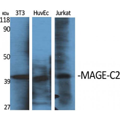 MAGEC2 / CT10 Antibody - Western blot of MAGE-C2 antibody